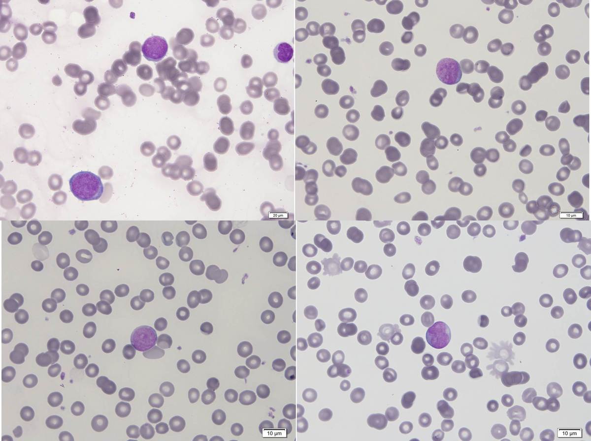 Figure 23 Recovery Aspirate